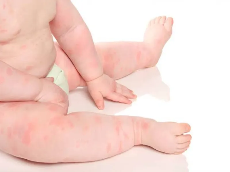 Rau sam tắm cho trẻ sơ sinh giúp da bé cảm thấy dễ chịu hơn khi bị kích ứng nhẹ